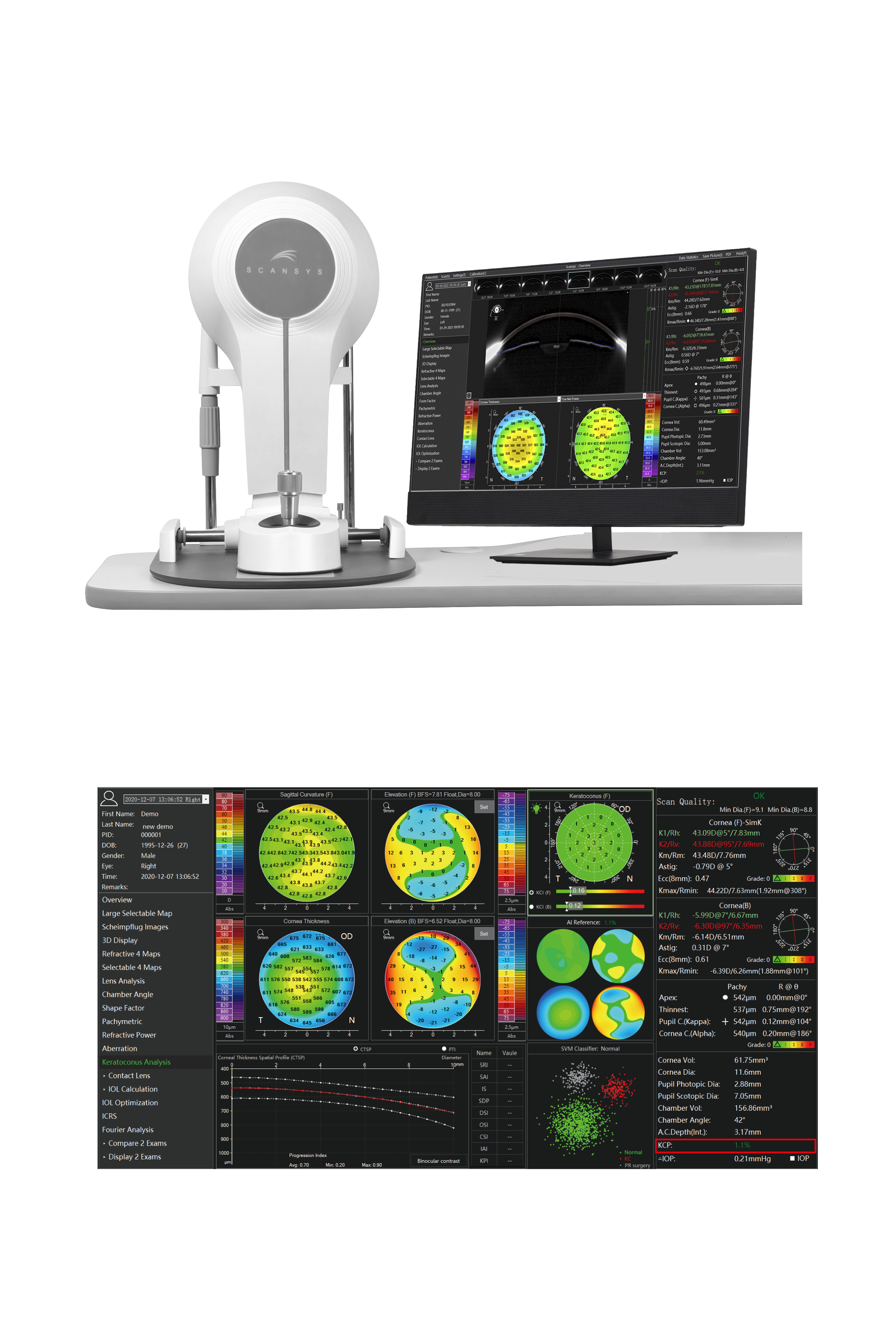 Scansys TA517 Anterior Segment Analyzer